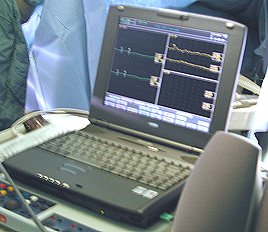 The intra-operative monitoring device used at the CCND, Winnipeg.