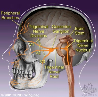 Trigeminal Neuralgia  on Anatomy Of Trigeminal Nerve By Chantal