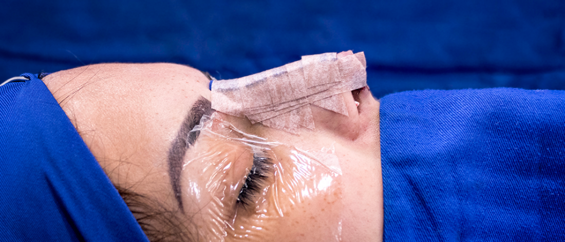 Profile view of a patient post rhinoplasty surgery.
