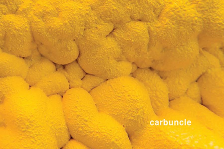 Carbuncle 2017 cover.