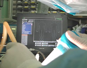 Intra-operative monitoring at use in the Operating Room.