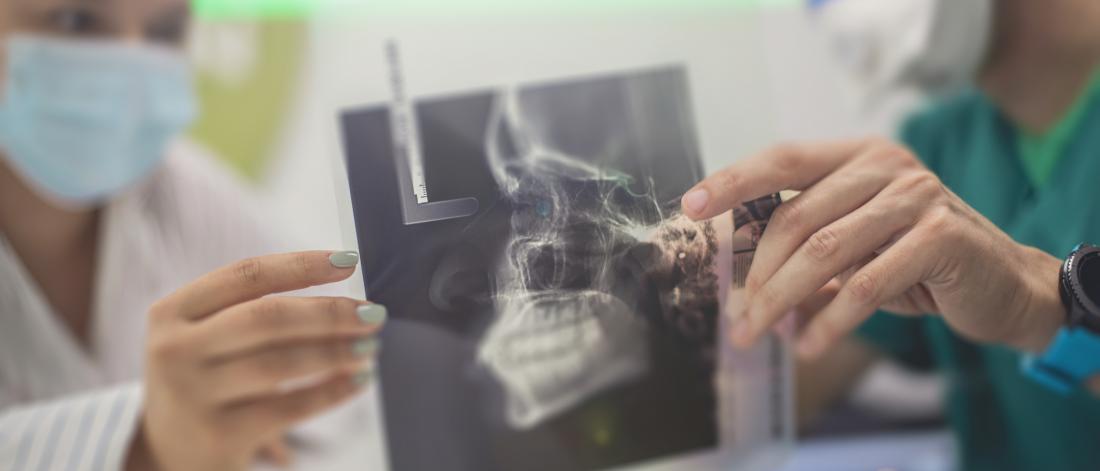Dentists examining an xray