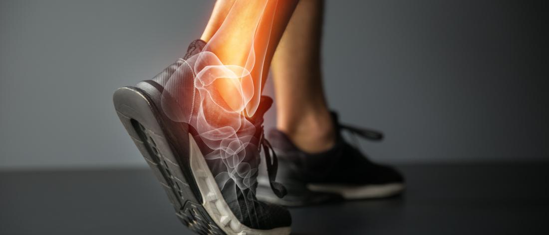 ankle bones.