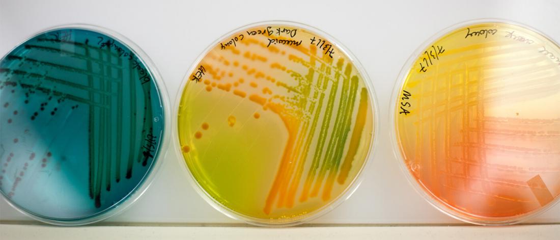 Three colourful petri dish filled with specimens.