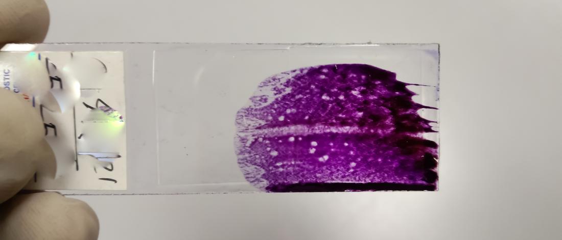 Close up of a stained slide.