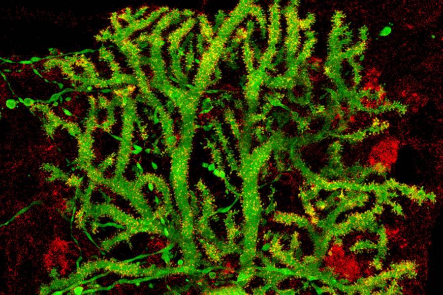 microscopic slide of cell structure from marzban lab.