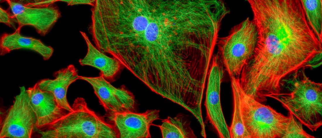 Close up of cells stained with brightly coloured chemicals.