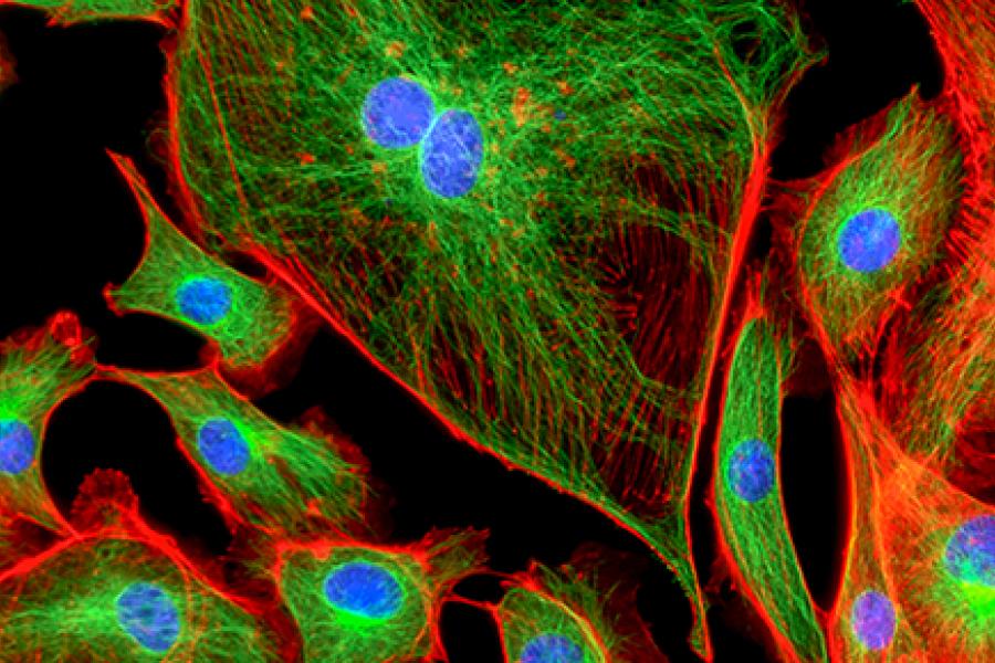 Close up of cells stained with brightly coloured chemicals.