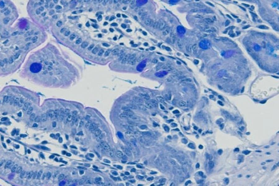 A close up of a slide with cells stained blue.