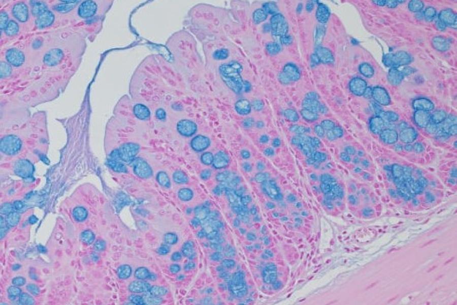 A slide with cells stained pink and blue.
