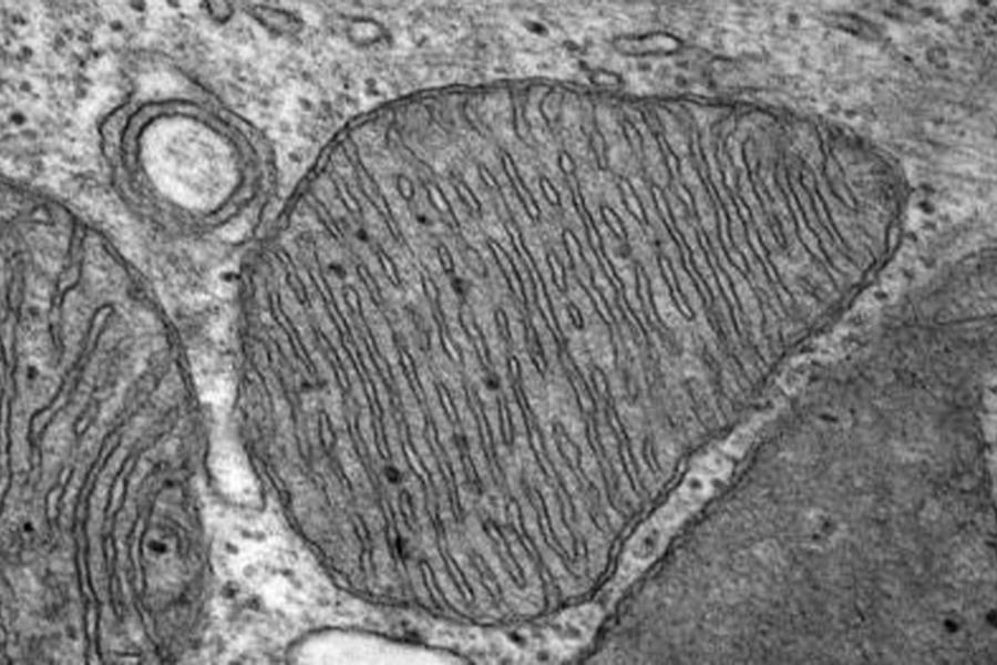 TEM image of a mitochondria.