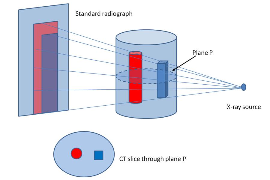 Complex diagram showing a CT image versus a conventional radiograph.