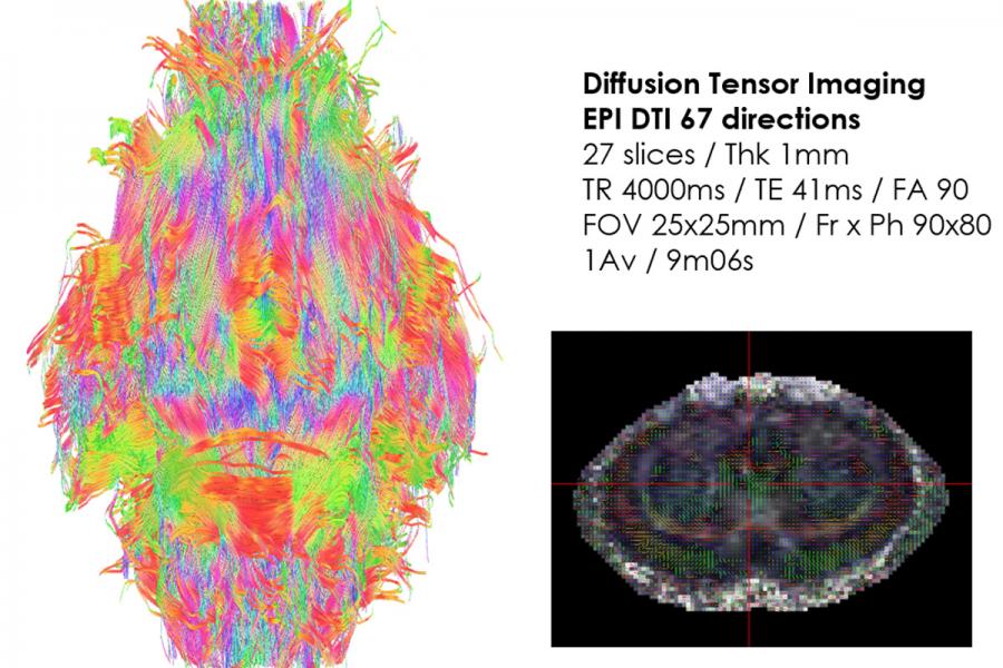 Diffusion tensor imaging of the rat brain.