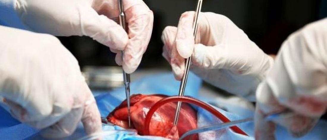 Heart surgery close-up.