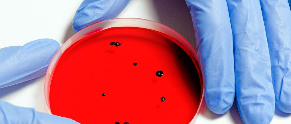Gloved hands holding a petri dish.