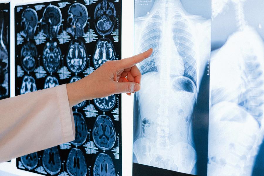 Physician with an xray.