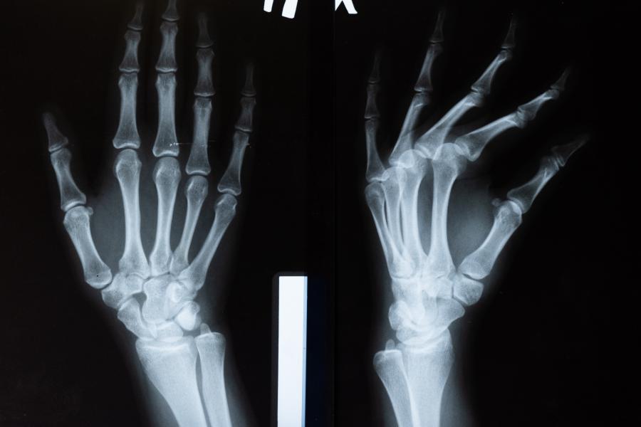 xray image of a hand.