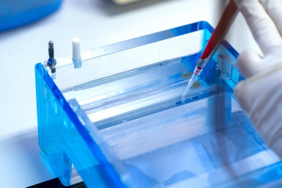 Molecular technique gel electrophoresis for DNA sample method decrypt the genetic code. biochemistry and clinical chemistry in laboratory.
